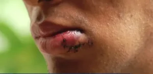 Estudiante golpeado