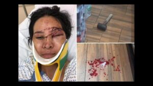 Mujer golpeada en NY