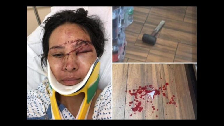 Mujer golpeada en NY