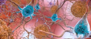 Alzheimer cura