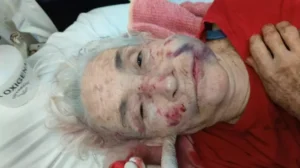 MUJERBRUTALMENTEGOLPEADA