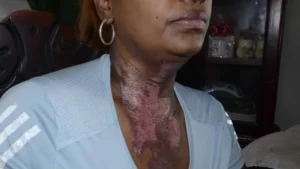 victima-de-intento-de-feminicidio-denuncia-abandono-de-autoridades-focus-0-0-896-504