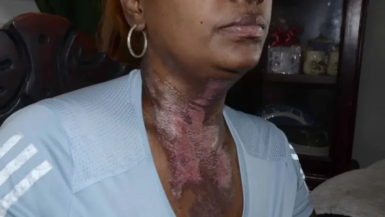 victima-de-intento-de-feminicidio-denuncia-abandono-de-autoridades-focus-0-0-896-504