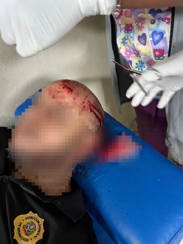 Haitianos enfrentan a agentes de migracion RD