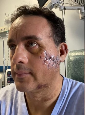 Mauricio Hoyos, mordido por tiburon