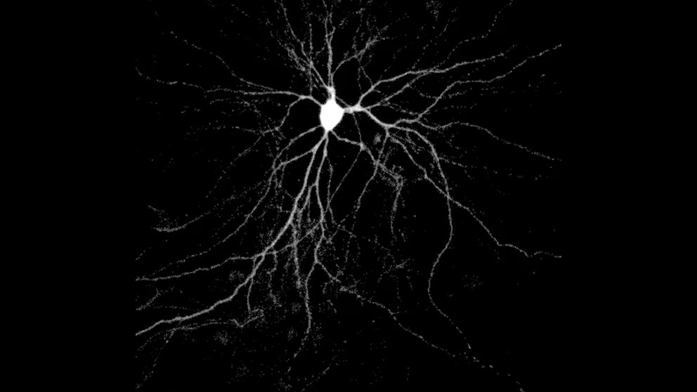Descubren cómo una proteína cerebral expande la enfermedad de Alzheimer de neurona a neurona