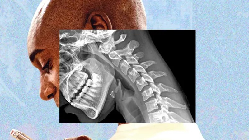 Columna encorvada por uso tecnlogia