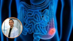 Aumenta el cancer colorectal