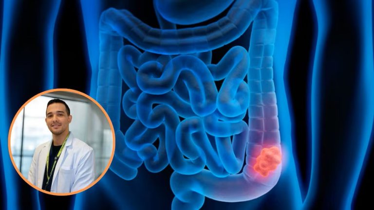Por qué crecen los diagnósticos de cáncer colorrectal antes de los 40 años: estos son los síntomas de alerta