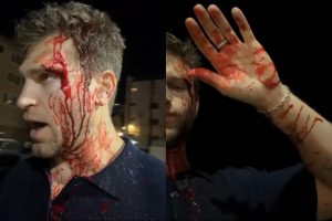 El actor Keegan Allen, conocido por interpretar a Toby Cavanaugh